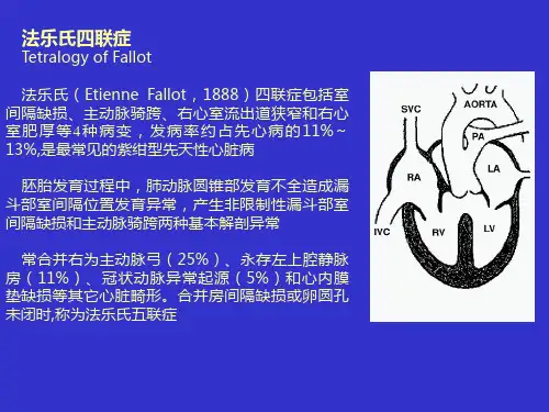心脏超声课件：法乐氏四联症
