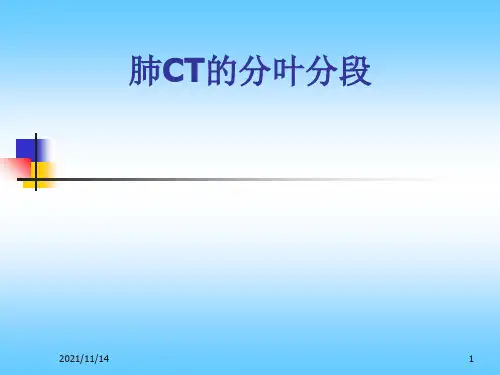 肺分叶分段