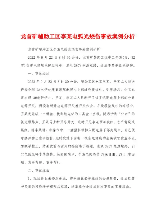 龙首矿辅助工区李某电弧光烧伤事故案例分析