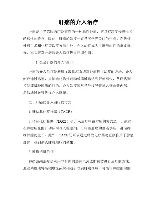 肝癌的介入治疗