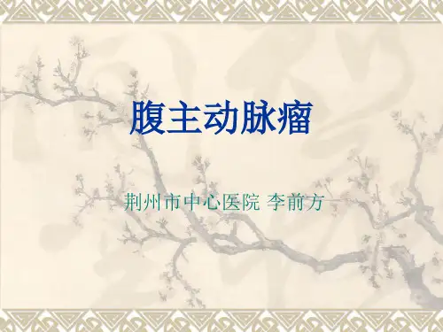 腹主动脉瘤