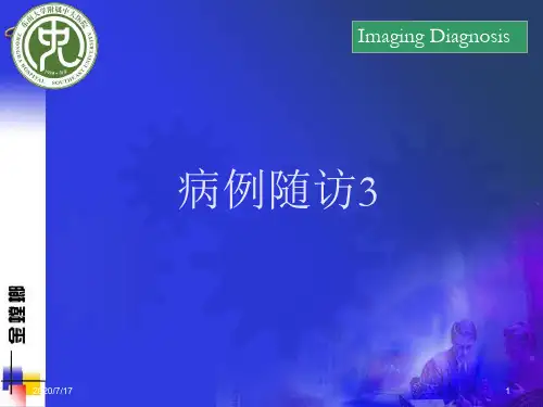 神经纤维瘤病PPT