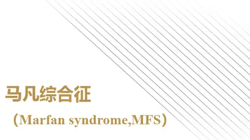 马凡综合征介绍