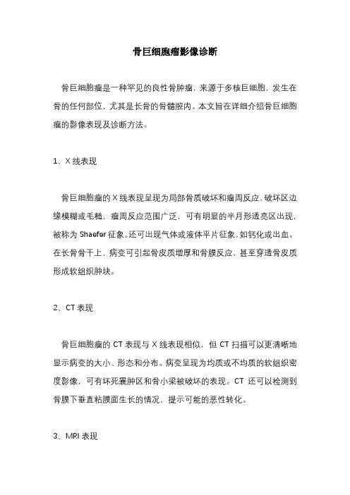 骨巨细胞瘤影像诊断