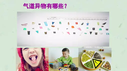 异物急救方法课件
