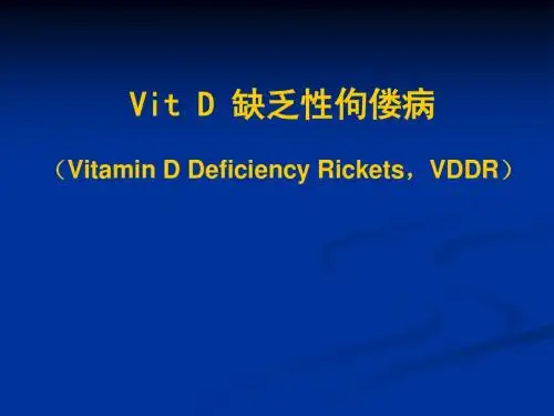 维生素D缺乏性佝偻病课件