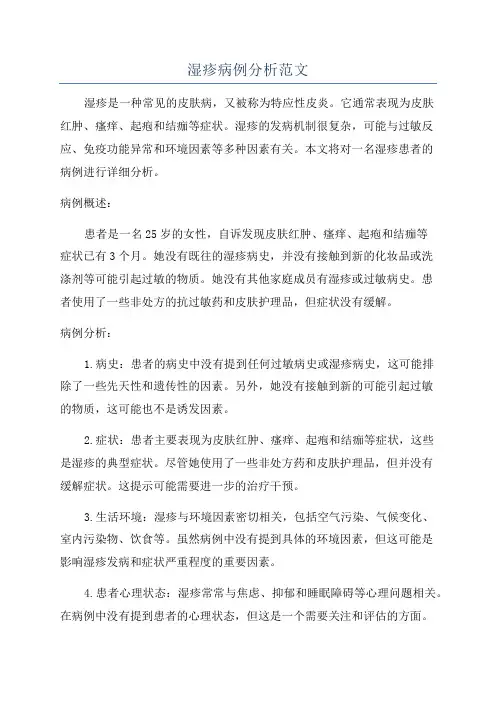 湿疹病例分析范文