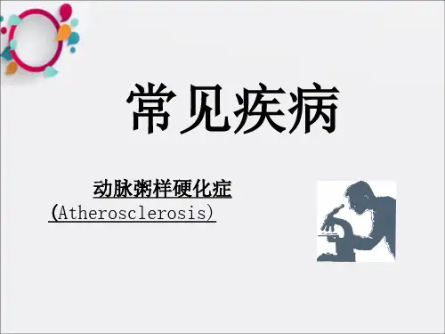 《动脉粥样硬化症》PPT课件