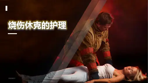 烧伤患者休克期的护理