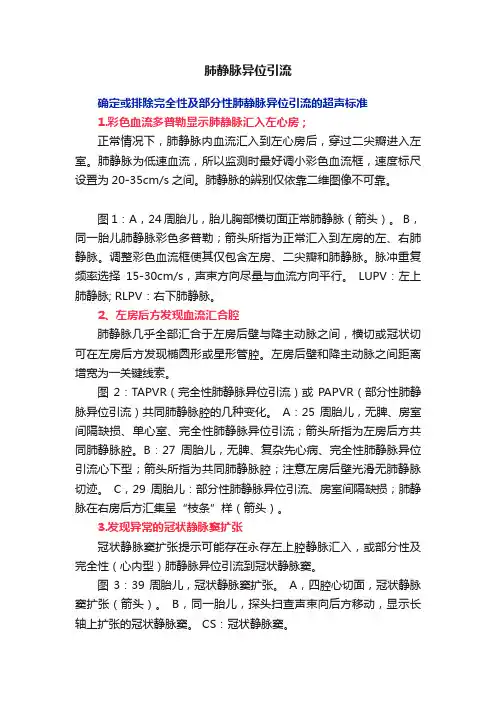 肺静脉异位引流