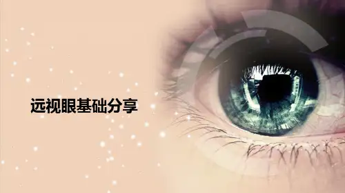 远视眼基础