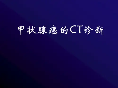 甲状腺癌的CT诊断PPT课件