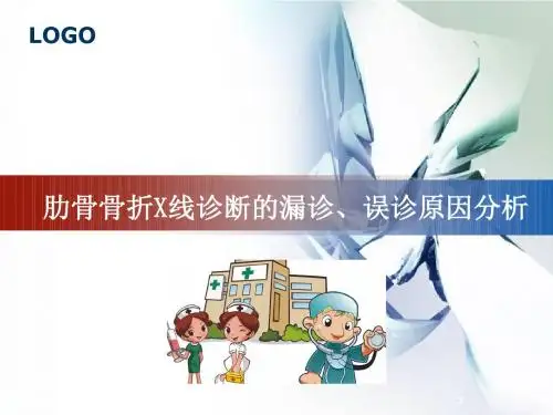 肋骨骨折的影像学表现医学PPT课件