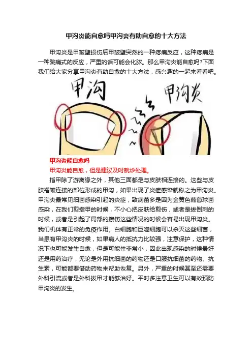 甲沟炎能自愈吗甲沟炎有助自愈的十大方法