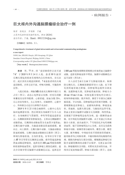 巨大颅内外沟通脑膜瘤综合治疗一例