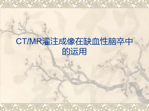 灌注成像