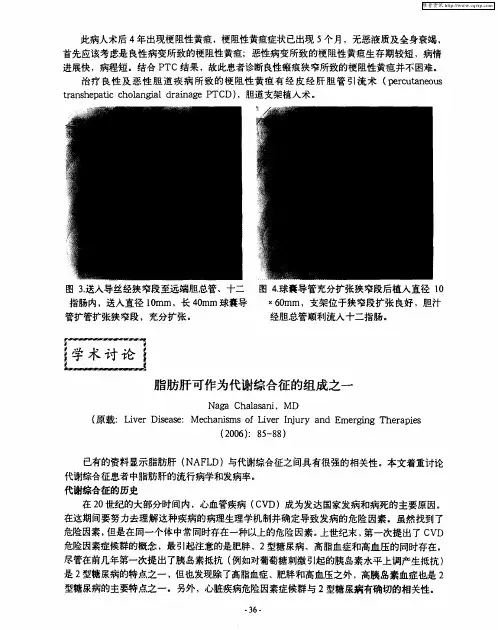 脂肪肝可作为代谢综合征的组成之一