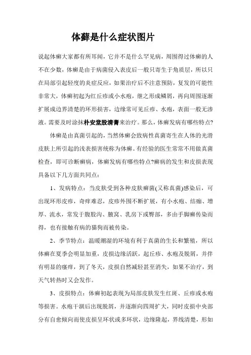 体藓是什么症状图片