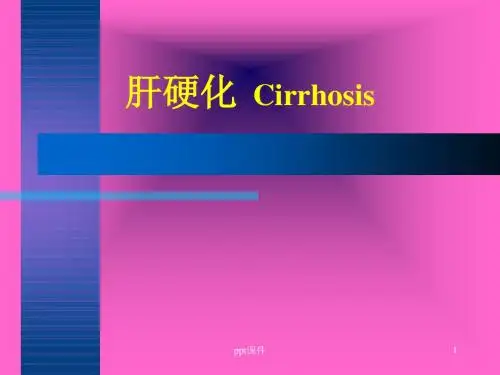 内科学--肝硬化  ppt课件