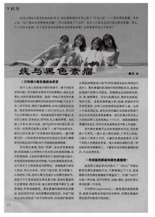 痣与黑色素瘤