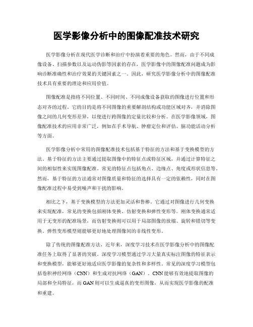 医学影像分析中的图像配准技术研究