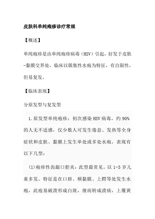 皮肤科单纯疱疹诊疗常规