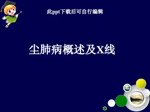 尘肺病概述及X线ppt课件