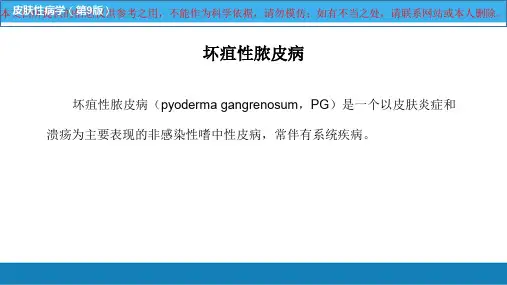 坏疽性脓皮病培训课件