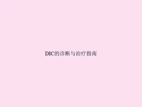 DIC的诊断与治疗指南