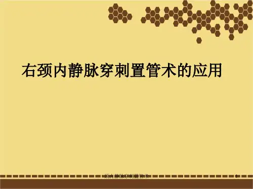 颈内静脉穿刺置管术课件