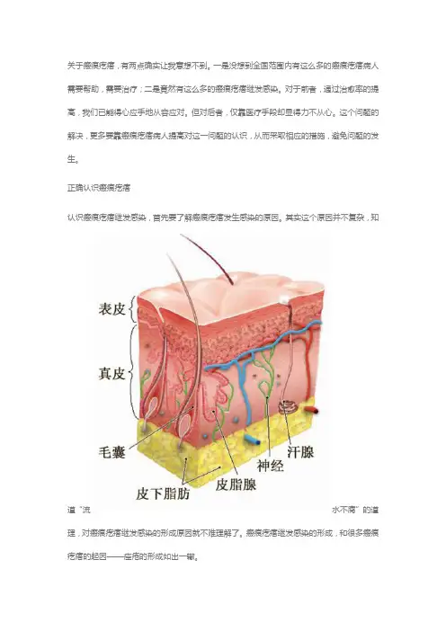 瘢痕疙瘩处理办法
