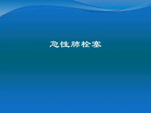 2019年急性肺栓塞.ppt