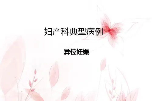 异位妊娠