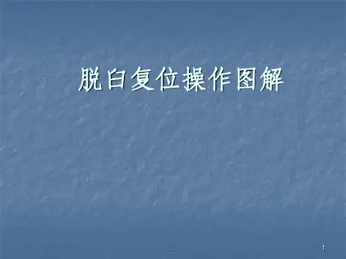 脱臼复位术
