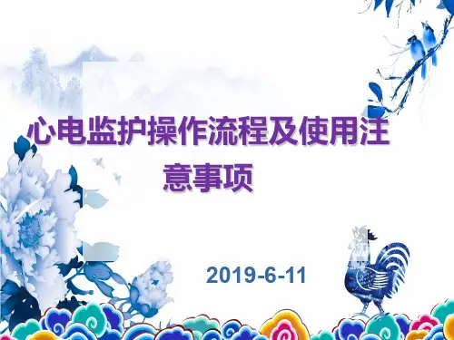 心电监护操作流程及注意事项