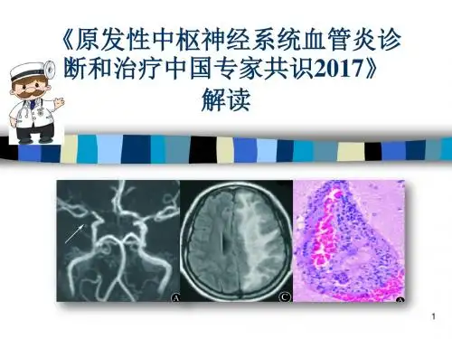 《原发性中枢神经系统血管炎诊断和治疗中国专家共识》解读医学PPT课件