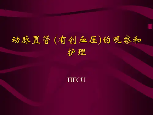 护理动脉置管
