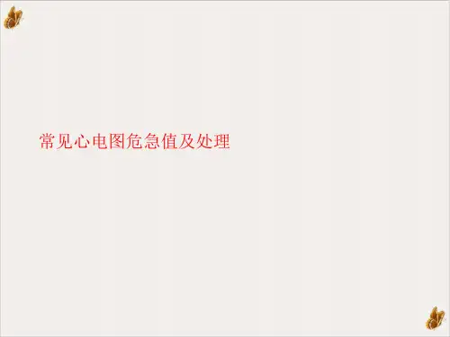 常见心电图危急值及处理ppt课件