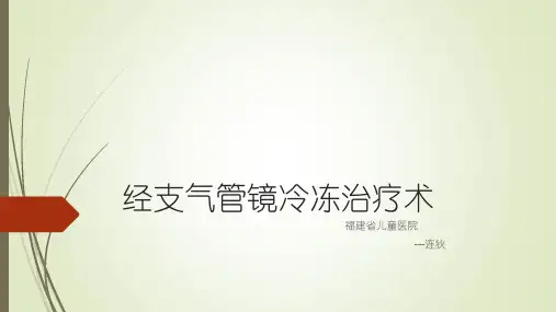 经支气管镜冷冻治疗术