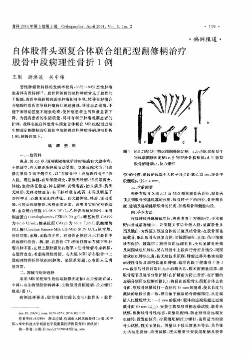 自体股骨头颈复合体联合组配型翻修柄治疗股骨中段病理性骨折1例