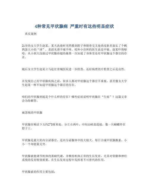 4种常见甲状腺病 严重时有这些明显症状
