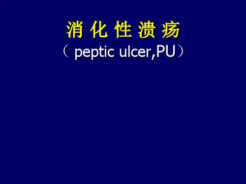 消化性溃疡-03-04