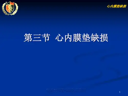 2-2-3心内膜垫缺损