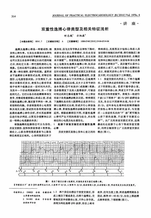 双重性逸搏心律类型及相关特征浅析