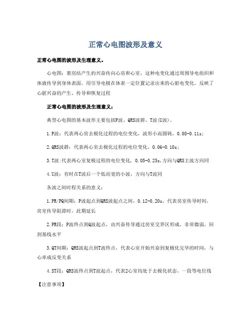 正常心电图波形及意义