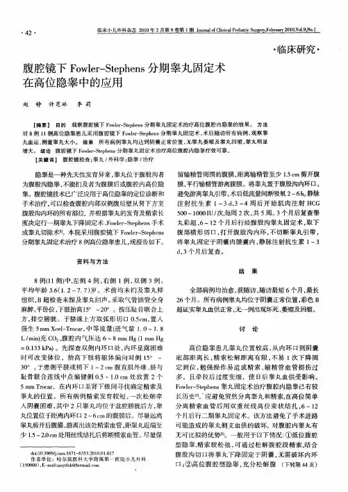 腹腔镜下Fowler—Stephens分期睾丸固定术在高位隐睾中的应用