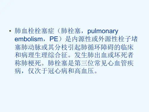 肺血栓栓塞症肺栓塞
