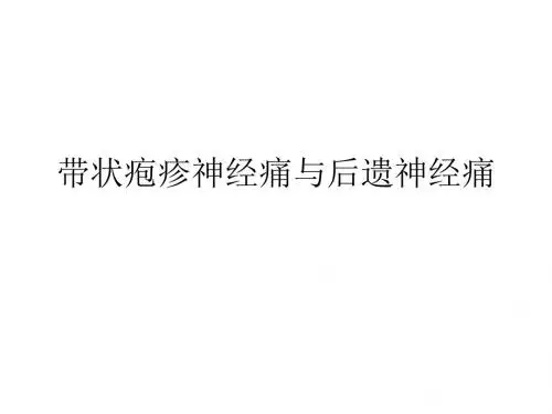 带状疱疹神经痛与后遗神经痛去