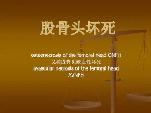 股骨头坏死的—讲稿贾课件
