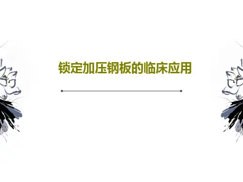 锁定加压钢板的临床应用PPT共30页